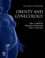 Tahir A. Mahmood, Sabaratnam Arulkumaran, Frank A. Chervenak - Obesity and Gynecology, Häftad