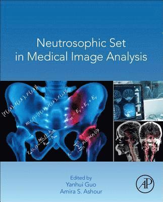 bokomslag Neutrosophic Set in Medical Image Analysis