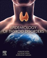 Jahangir Moini, Katherine Pereira, Mohtashem Samsam - Epidemiology of Thyroid Disorders, Häftad