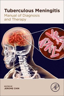 Tuberculous Meningitis 1