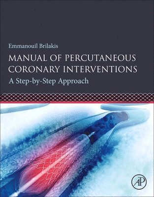 Manual of Percutaneous Coronary Interventions 1