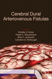 bokomslag Cerebral Dural Arteriovenous Fistulas