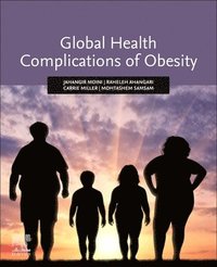 bokomslag Global Health Complications of Obesity