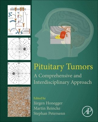 bokomslag Pituitary Tumors