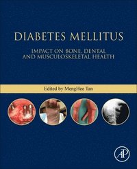 bokomslag Diabetes Mellitus