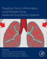 bokomslag Targeting Chronic Inflammatory Lung Diseases Using Advanced Drug Delivery Systems