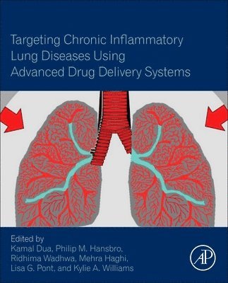 Targeting Chronic Inflammatory Lung Diseases Using Advanced Drug Delivery Systems 1
