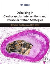 bokomslag Debulking in Cardiovascular Interventions and Revascularization Strategies