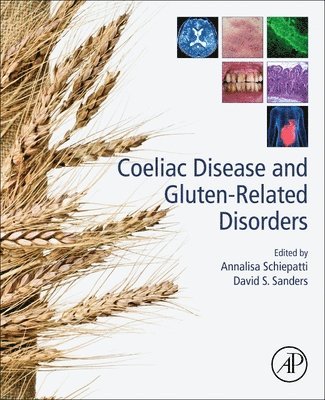 bokomslag Coeliac Disease and Gluten-Related Disorders