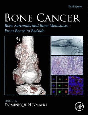 bokomslag Bone Cancer