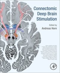 bokomslag Connectomic Deep Brain Stimulation