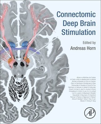 Connectomic Deep Brain Stimulation 1