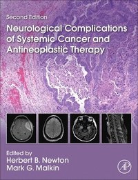 bokomslag Neurological Complications of Systemic Cancer and Antineoplastic Therapy