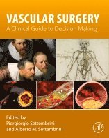Piergiorgio Settembrini, Alberto M. Settembrini - Vascular Surgery, Häftad