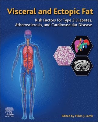 bokomslag Visceral and Ectopic Fat