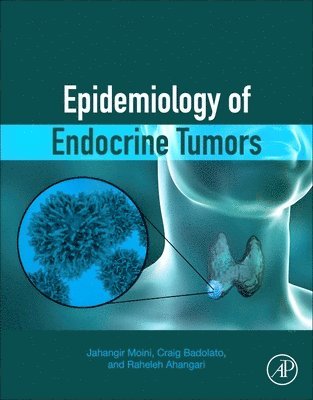 bokomslag Epidemiology of Endocrine Tumors