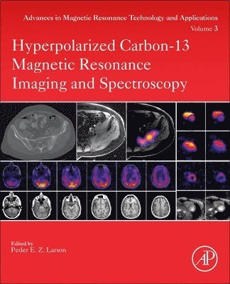 Hyperpolarized Carbon-13 Magnetic Resonance Imaging and Spectroscopy