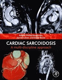 bokomslag Cardiac Sarcoidosis