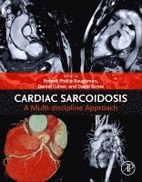 Robert Phillip Baughman, Daniel Culver, David Birnie - Cardiac Sarcoidosis, Häftad