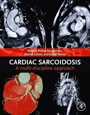 Cardiac Sarcoidosis 1
