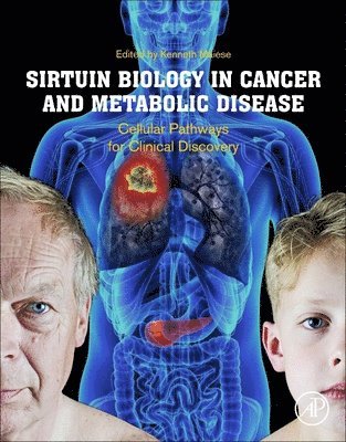 Kenneth Maiese, United States) Maiese, Kenneth (Biotechnology and Venture Capital Development, Office of Translational Alliances and Coordination, National Heart, Lung, and Blood Institute; Cellular and Molecular Signaling, New York, NY - Sirtuin Biology in Cancer and Metabolic Disease, Häftad