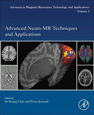 Advanced Neuro MR Techniques and Applications 1