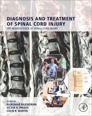 Diagnosis and Treatment of Spinal Cord Injury 1