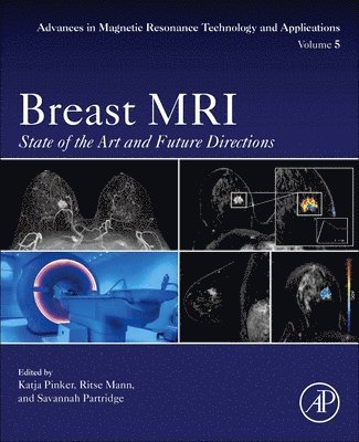 bokomslag Breast MRI