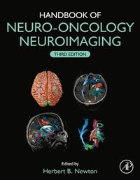 bokomslag Handbook of Neuro-Oncology Neuroimaging