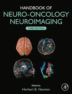 bokomslag Handbook of Neuro-Oncology Neuroimaging