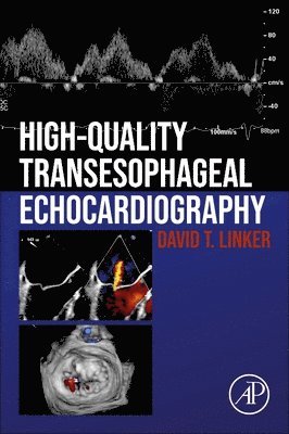 High-Quality Transesophageal Echocardiography 1
