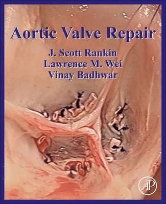 Aortic Valve Repair 1