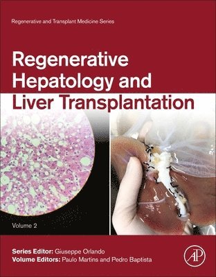 bokomslag Regenerative Hepatology and Liver Transplantation