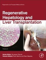 Paulo Martins, Pedro Baptista - Regenerative Hepatology and Liver Transplantation, Inbunden