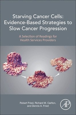 Starving Cancer Cells: Evidence-Based Strategies to Slow Cancer Progression 1