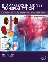 Dr Smita Pattanaik, Dr Ashish Sharma - Biomarkers in Kidney Transplantation, Häftad