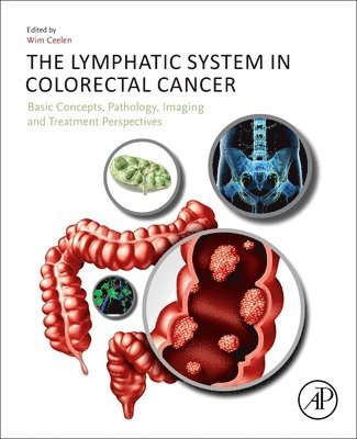 The Lymphatic System in Colorectal Cancer 1