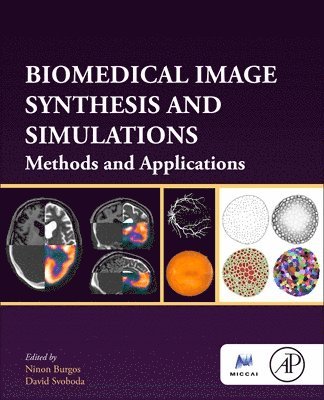 Biomedical Image Synthesis and Simulation 1