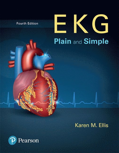 EKG Plain and Simple 1