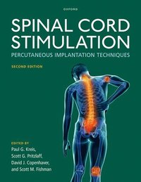bokomslag Spinal Cord Stimulation