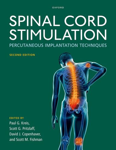 Paul G. Kreis, Paul G. Kreis, Scott G. Pritzlaff, David J. Copenhaver, Scott M. Fishman - Spinal Cord Stimulation, Inbunden