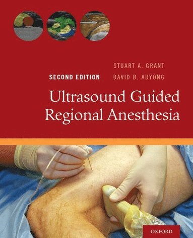 bokomslag Ultrasound Guided Regional Anesthesia