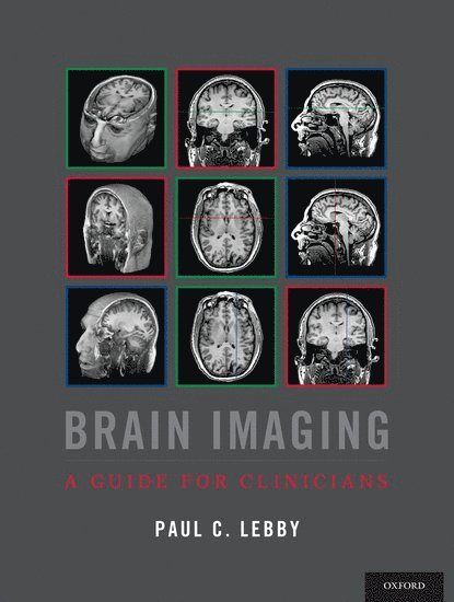 Brain Imaging 1