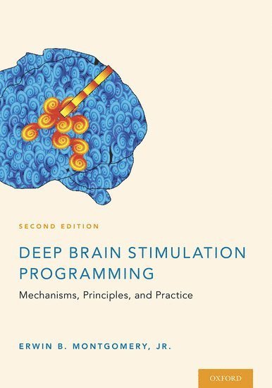 Deep Brain Stimulation Programming 1