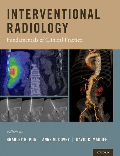 Bradley B. Pua, Anne M. Covey, David C. Madoff - Interventional Radiology, Inbunden