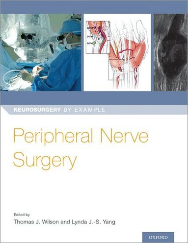 Thomas Wilson, Lynda J-S Yang - Peripheral Nerve Surgery, Häftad