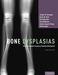 bokomslag Bone Dysplasias