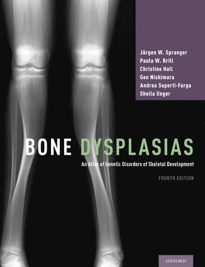 Bone Dysplasias 1