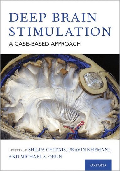 Shilpa Chitnis, Pravin Khemani, Michael S. Okun - Deep Brain Stimulation, Inbunden