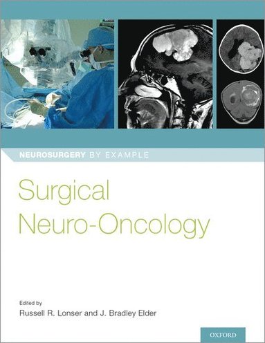 bokomslag Surgical Neuro-Oncology